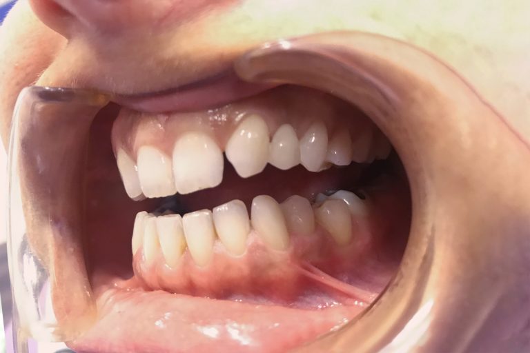 drkissdental-ref-updated-01-01
