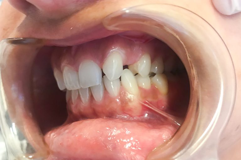 drkissdental-ref-updated-01-02