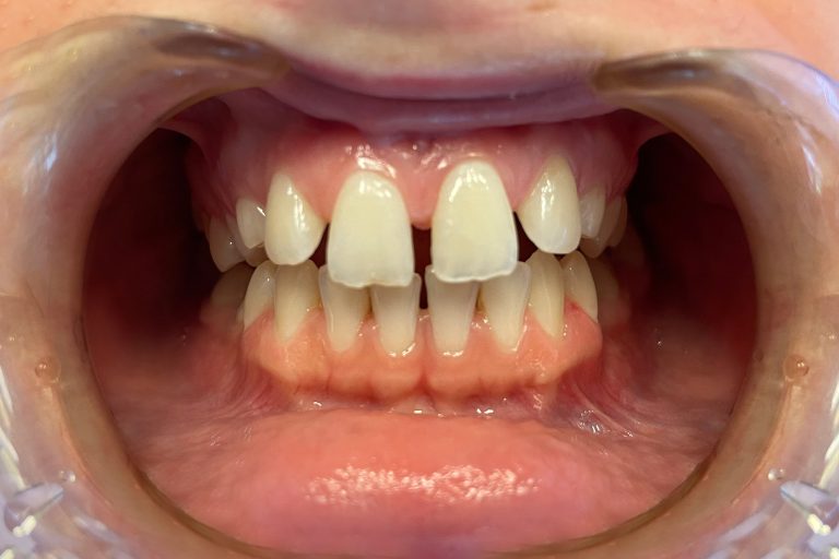 drkissdental-ref-updated-04-01
