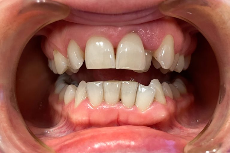 drkissdental-ref-updated-06-01